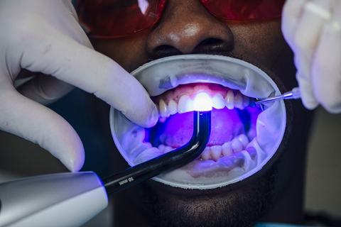 The latest dental-imaging techniques improve the visibility of cracks and cavities in teeth. Credit: Westend/Getty