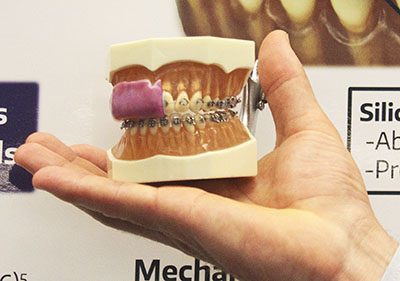 Mouthsheild model