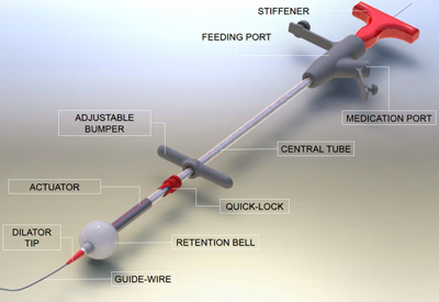 Diagram of an improved gastronomy tube